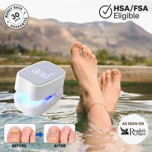 Angler Sway™ - Nail Fungus Laser Device